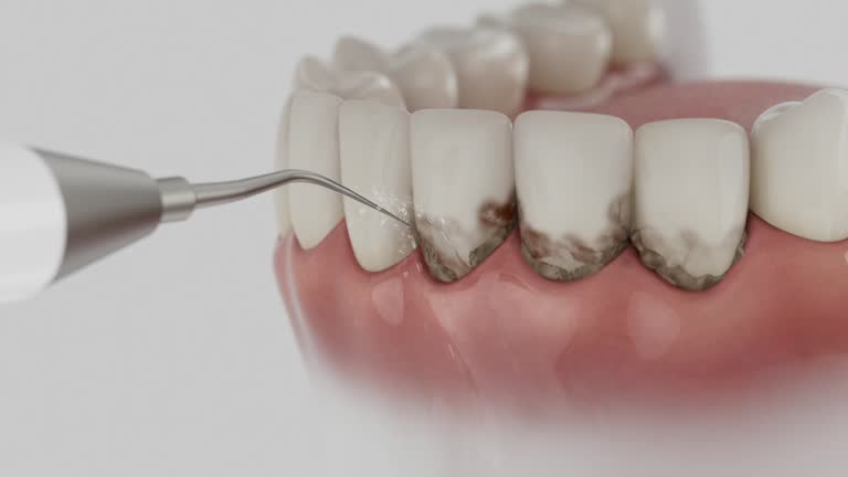 Trusted Emergency Dentist service in Rosedale, MD - Dentist Open Now
